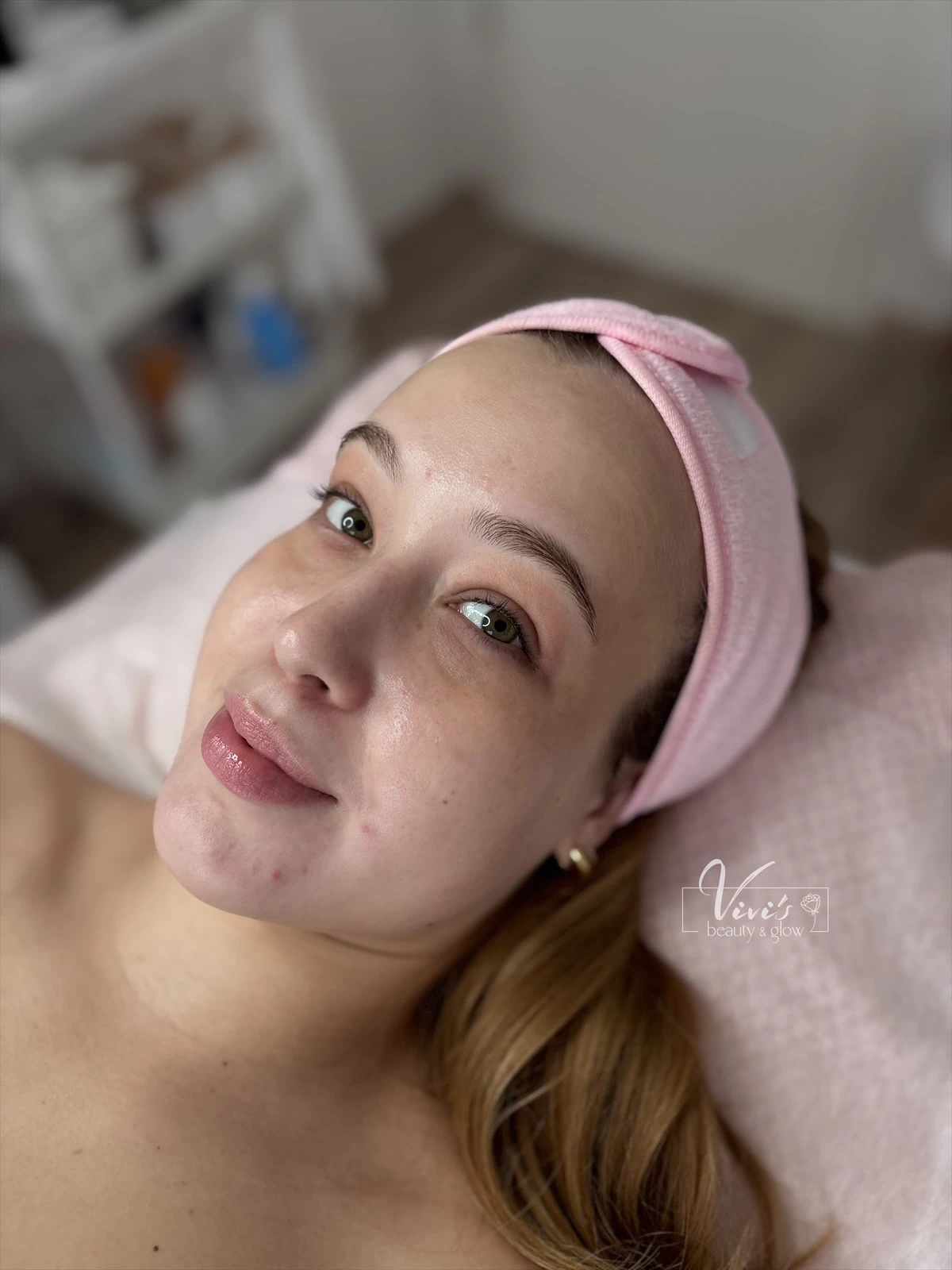 Inflacure rosacea és akne kezelés